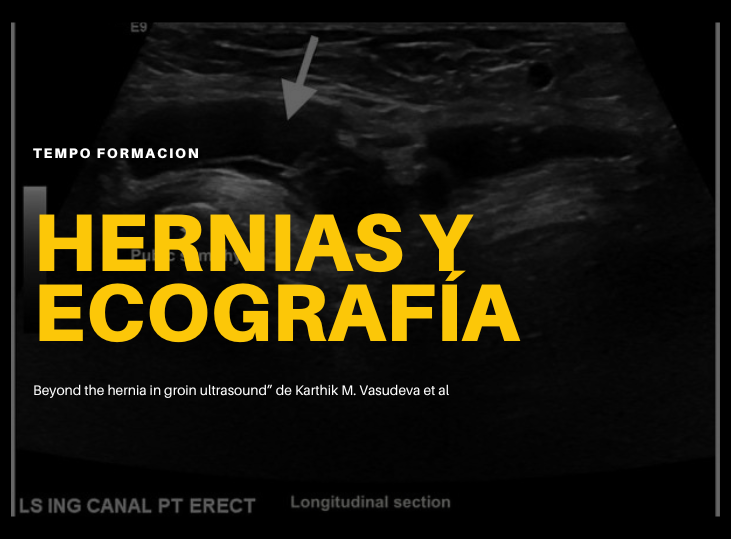 mas-alla-de-las-hernias-parte-i-ecografia